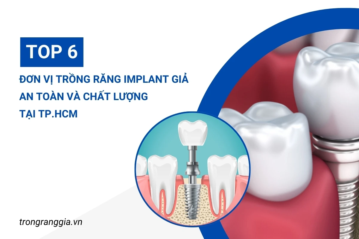 Đơn vị trồng răng implant