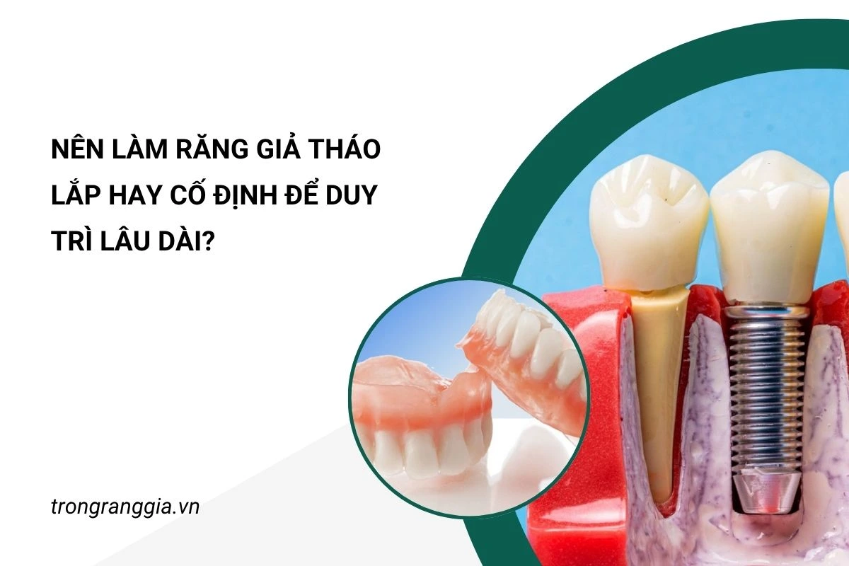 nên làm răng giả tháo lắp hay cố định